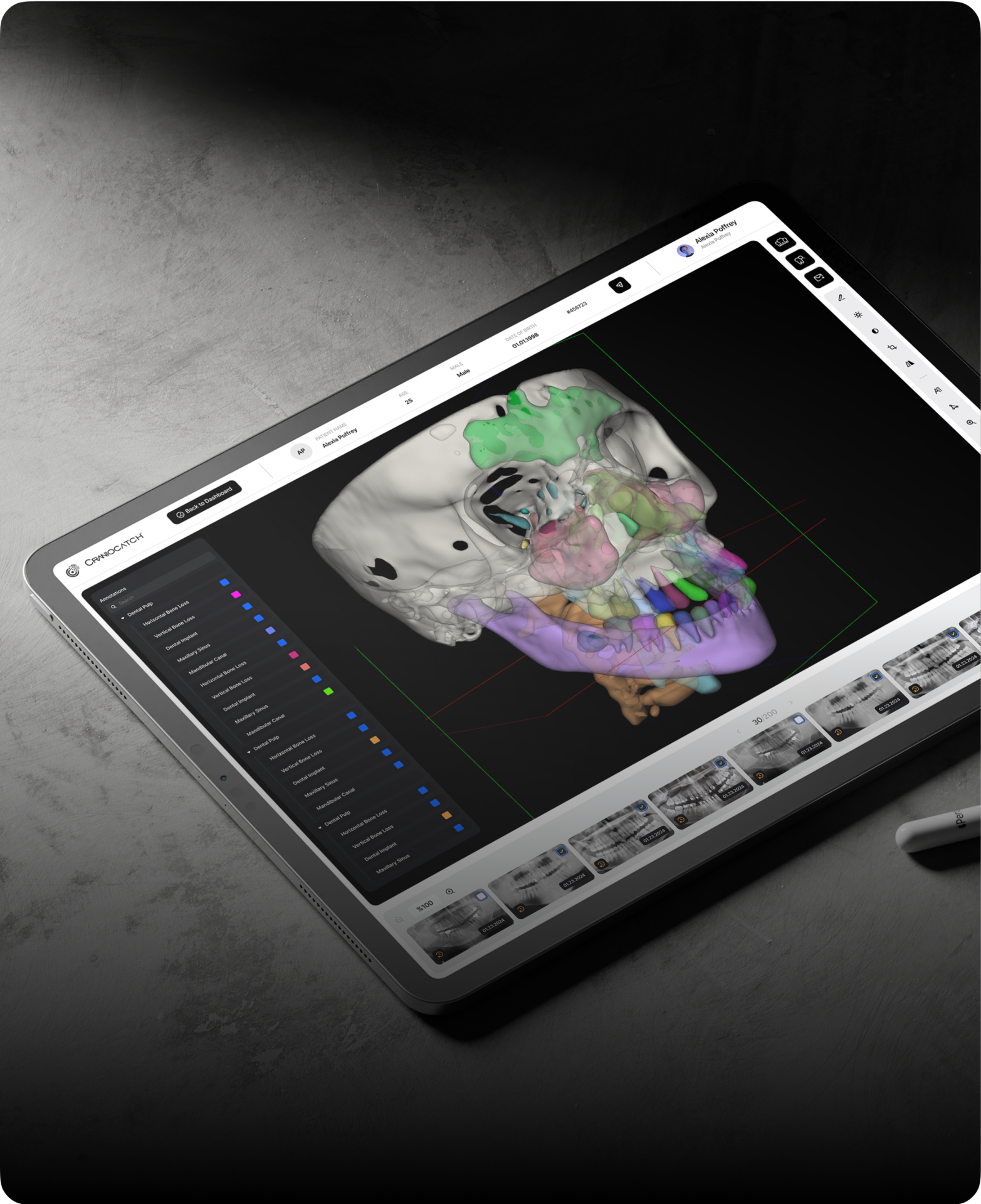 CranioCatch Dental AI Platform