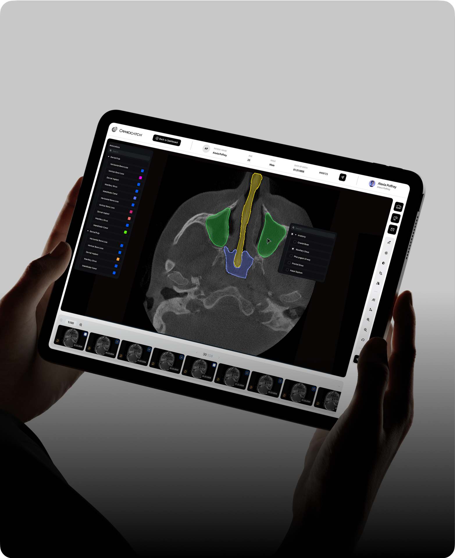 AI-Powered Dental Analysis